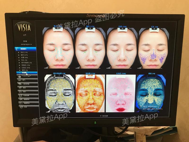 补水保湿美白蛋白精华,美白补水抗皱紧致胶原蛋白