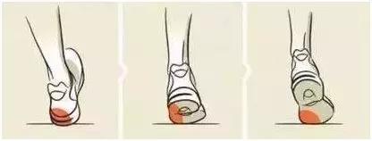 宝宝脚踝外翻真的是“病”么?