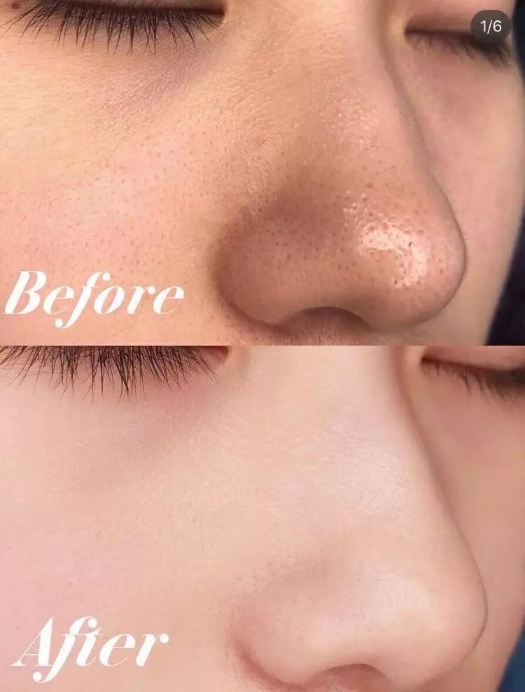 去螨虫慕斯推荐,洗面奶慕斯去螨虫