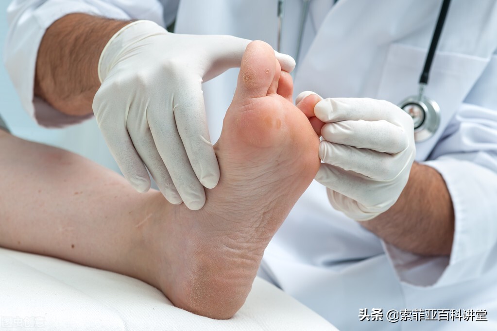 夏季灰指甲怎么去除,灰指甲一到夏天就犯怎么办