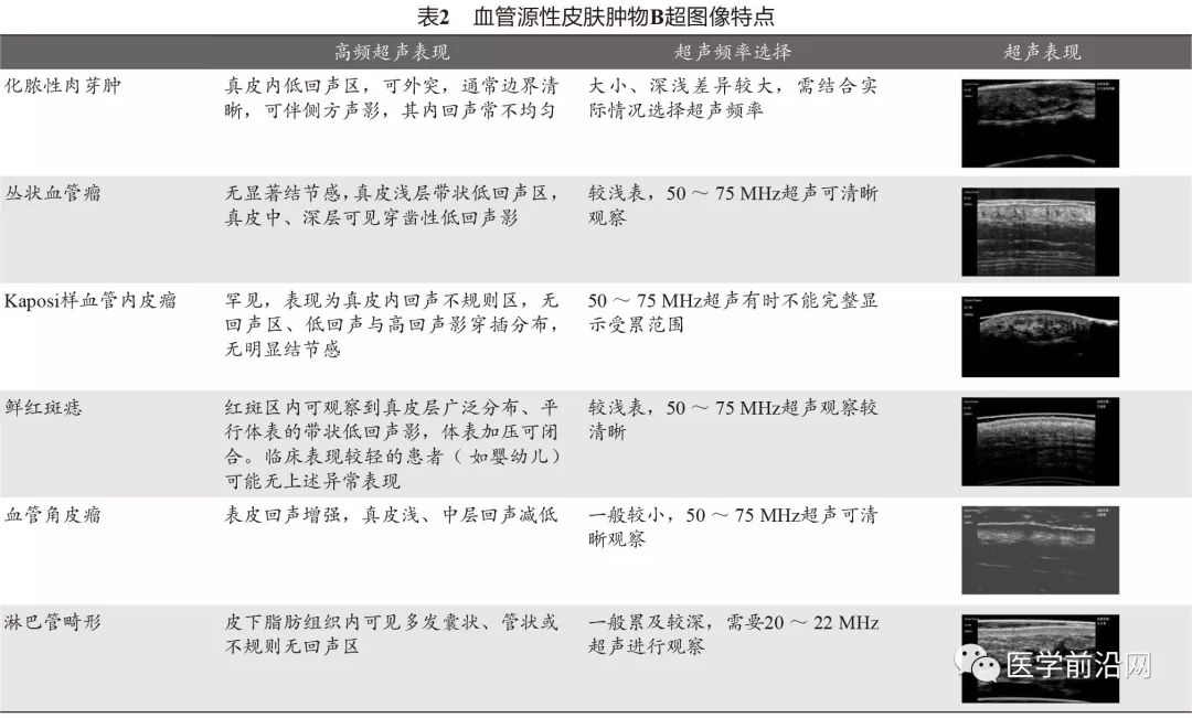 常见皮肤病高频皮肤超声诊断专家共识全文发布