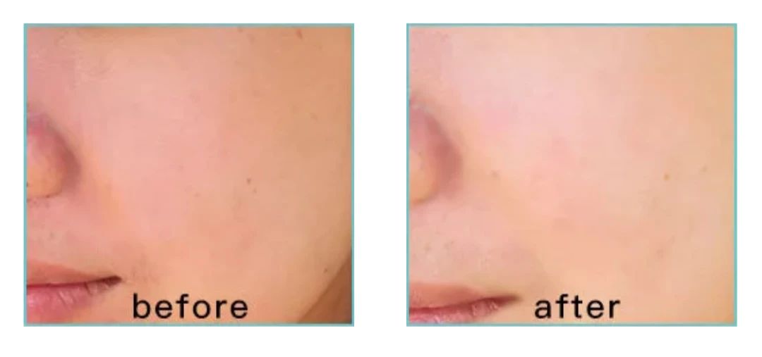 美白单靠防晒可以吗,美白靠bb霜就够了吗