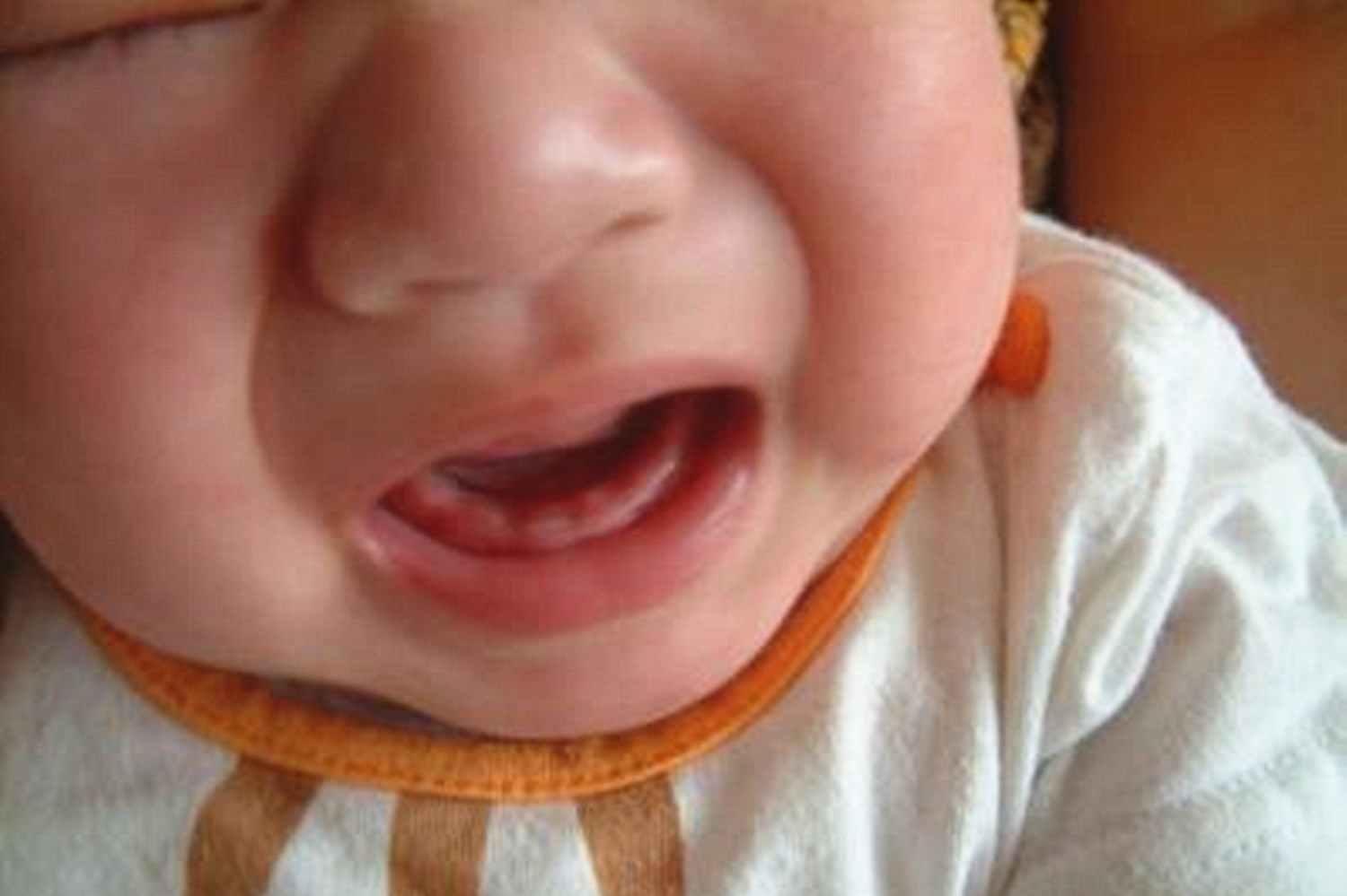 宝宝持续低烧是出牙吗,宝宝低烧时牙龈咯咯响