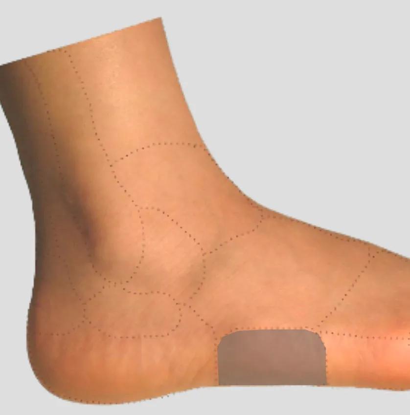 足踝各种疼痛的原因,足踝内侧疼痛自测