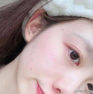 20岁的年纪最容易乱用护肤品,这样护肤才不会变敏感肌