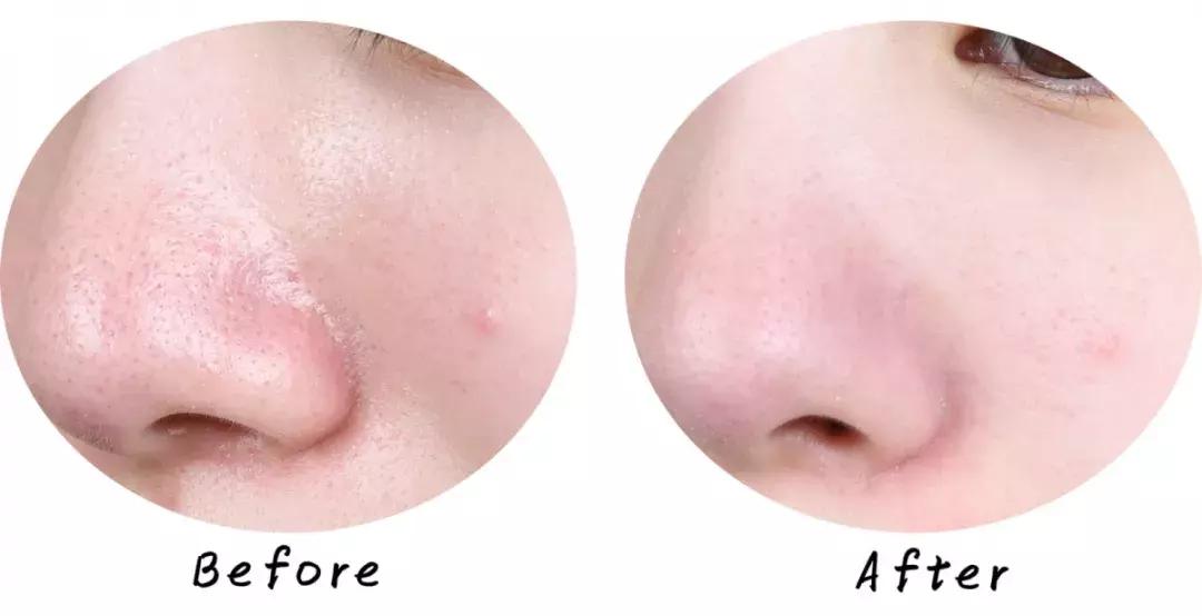 swisse麦卢卡蜂蜜排毒清洁面膜,超温和清洁面膜推荐哪个