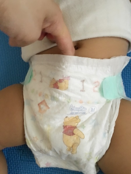 宝宝拉屎漏尿正确方法,宝宝红屁屁漏尿怎么回事