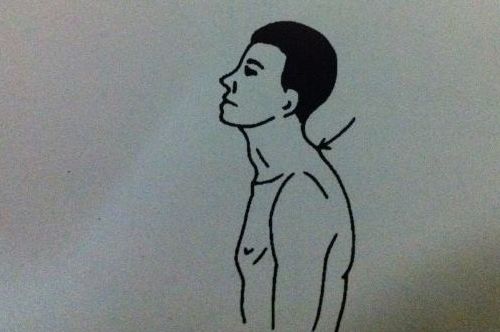 颈椎肩膀僵硬酸痛吃什么药,如何治疗颈椎病脖子和肩膀疼