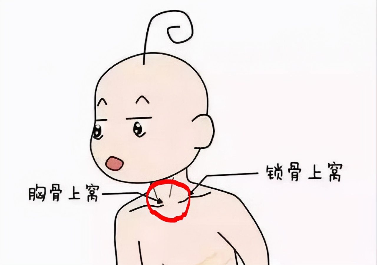 icu救治,icu抢救成功案例