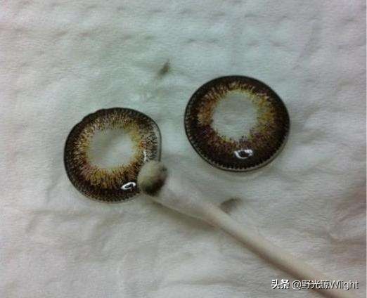 网购美瞳发炎怎么办,网购美瞳出现质量问题