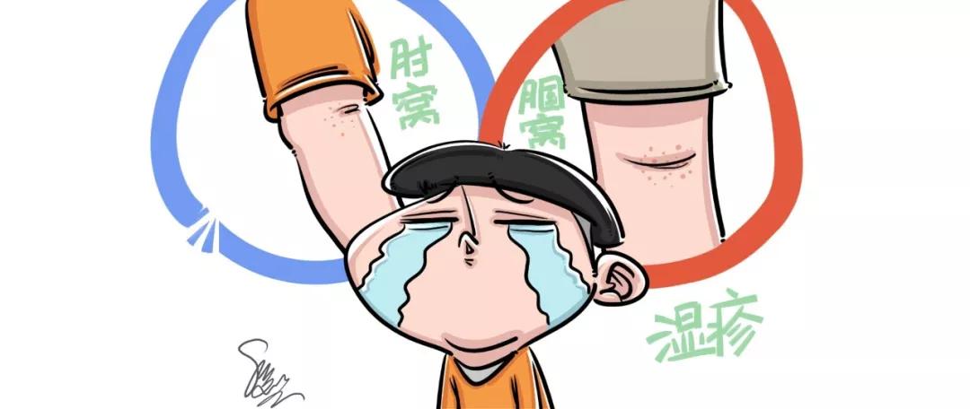 大人内热引起的湿疹怎么处理,体热会引起湿疹吗