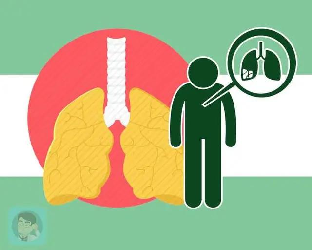 肺结核病史孕妇感染新冠肺炎,孕妇感染新冠胎儿白肺