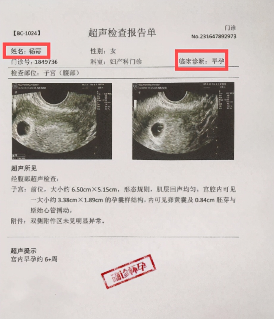 杨幂晒漫画腰惹非议,杨幂被传怀二胎