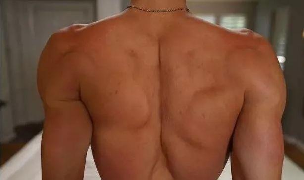 关于隆胸手术你想知道的那些事,隆胸丰臀整形