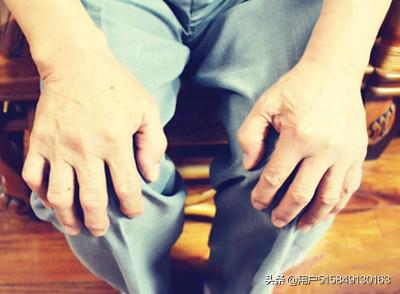 左腿骨质增生补什么钙片,骨质增生怎么补骨胶原