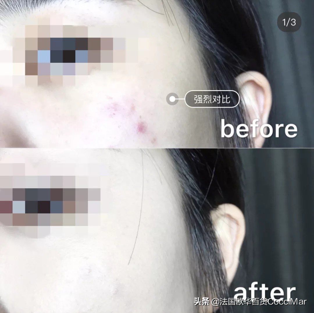 范冰冰一年敷700多张面膜,一年用100张面膜正常吗