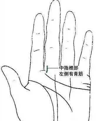 刮青筋防脑血栓,刮中指青筋防脑血栓