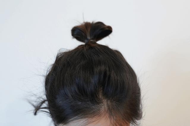 扁头怎么让头变得饱满些,扁头怎么办最快最有效