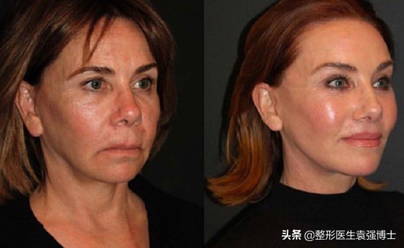 50岁抗褶皱紧致精华,50岁用什么抗衰紧致面霜