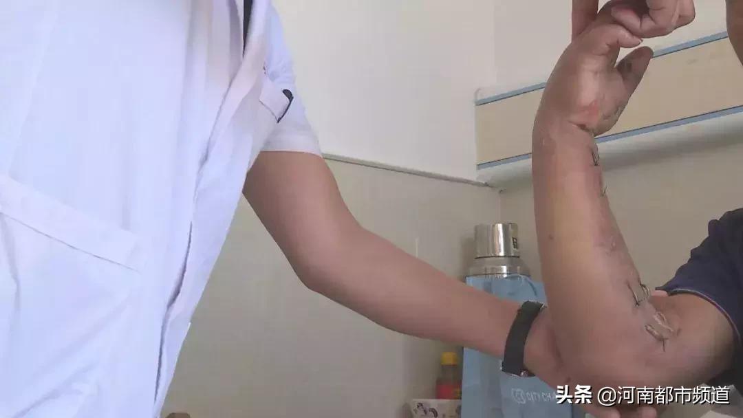 男子被虾刺刺伤伤残能赔付吗,一男子被虾刺身亡