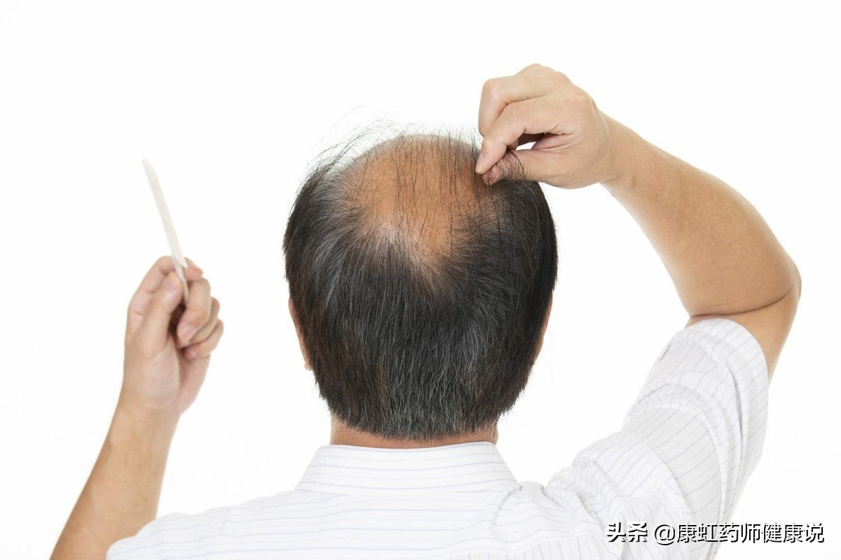 长白头发代表老了吗,年轻人长白头发的原因及调理