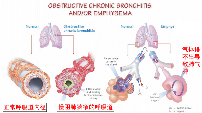 呼吸机st和s9有什么区别,s9vpap