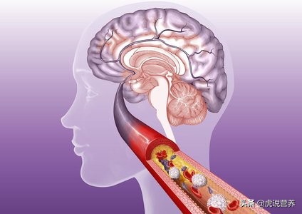 噩梦多梦是什么原因引起的,人多梦什么原因