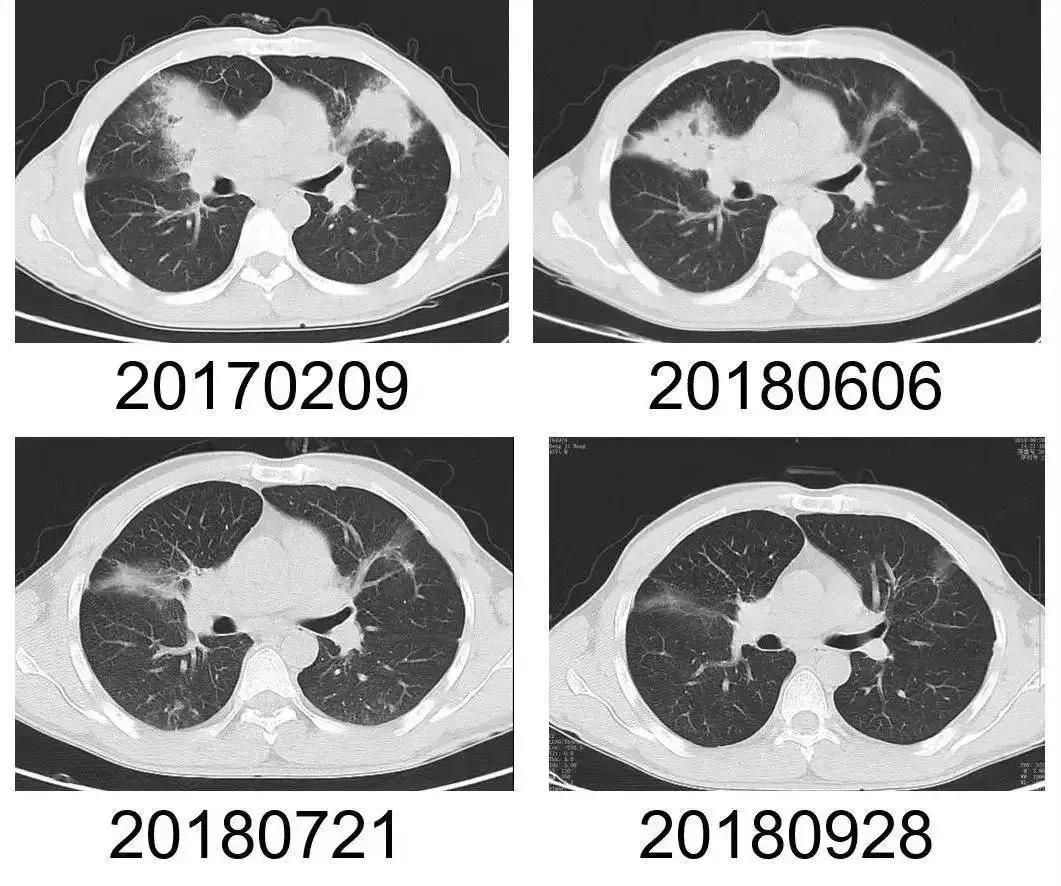 他摸了出土*物文**后,住院八次!