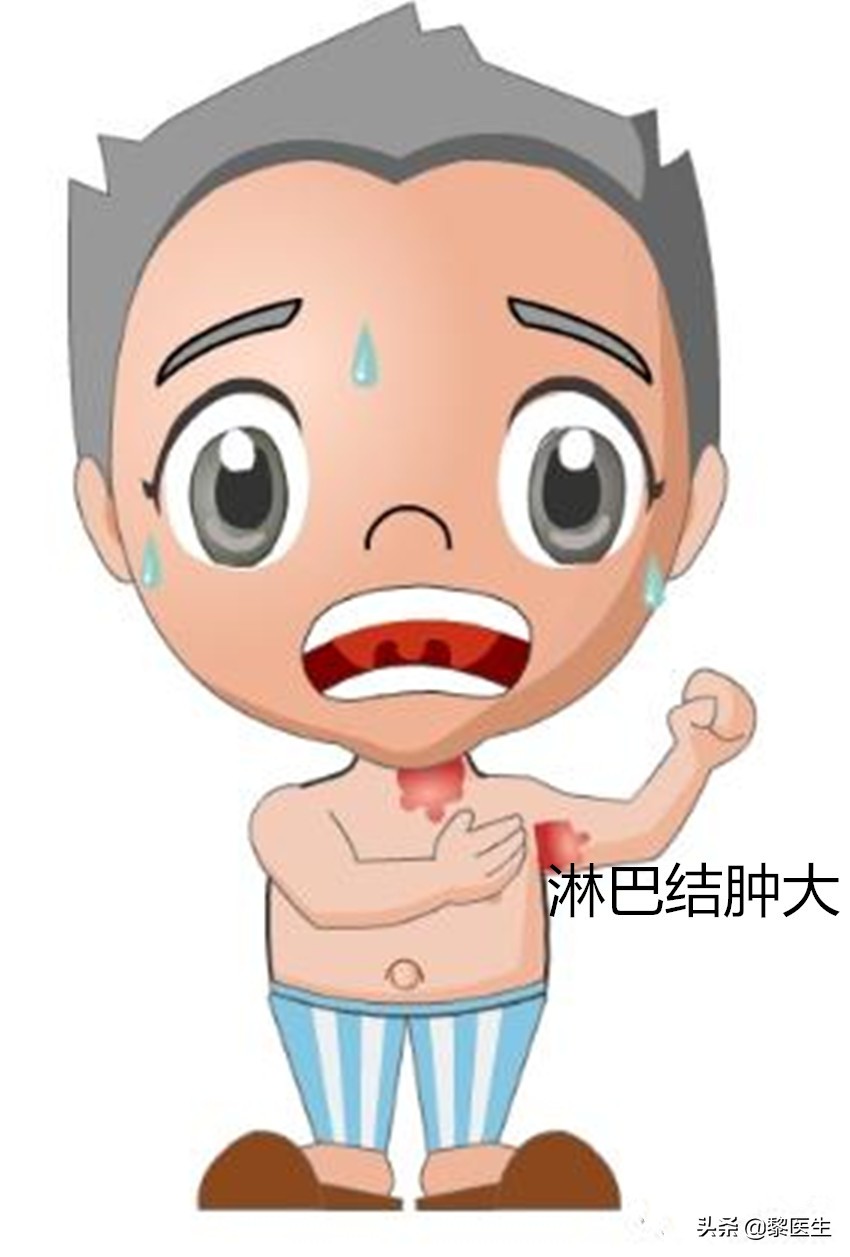 预防鼠疫喝板蓝根管用吗,预防控制鼠疫的主要措施