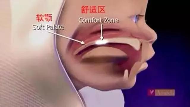 「二」乳头内陷能亲喂吗？新手妈妈需要有什么样的心理素质？