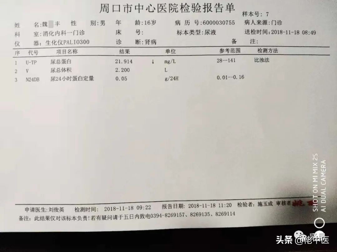 儿童肾病综合征吃激素药多久起效,儿童肾病综合征尿蛋白3+是复发吗