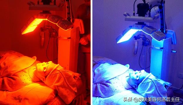 战痘神器效果怎么样,治痘神器国货