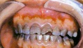 你的牙齿变黄了怎么办,你的牙齿为什么会那么白