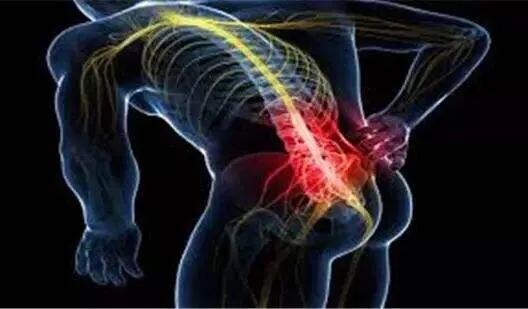 如何摆脱腰背疼的办法,如何减轻背部疼痛