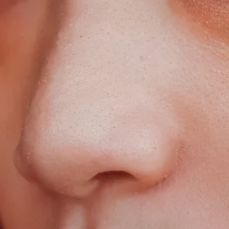 祛黑头踩过的坑