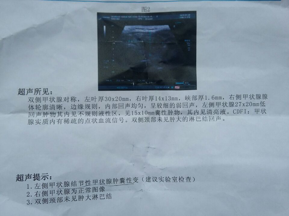 甲状腺结节从外观上可以看出来吗,甲状腺结节4ab超报告单