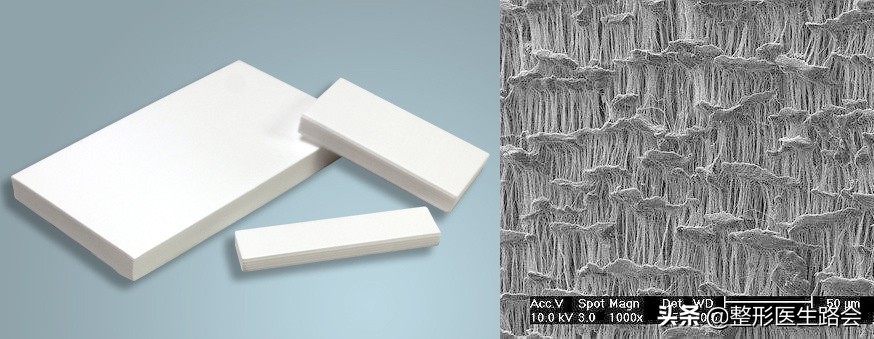 假体材料都有哪几种,假体材料都有什么