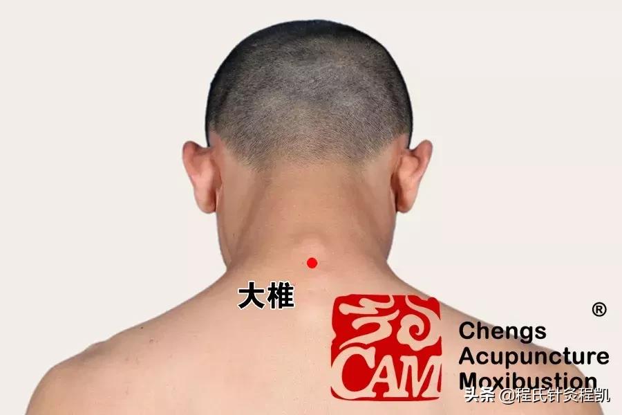 腰痛有寒湿气怎样拔火罐,寒湿腰痛一招解决