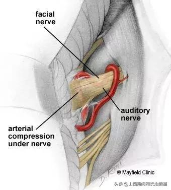 长治市和平医院能做减压手术吗,长治市和平医院动脉介入手术