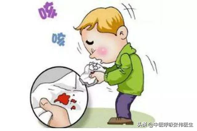 最常见的咯血原因是,支气管扩张咯血原因