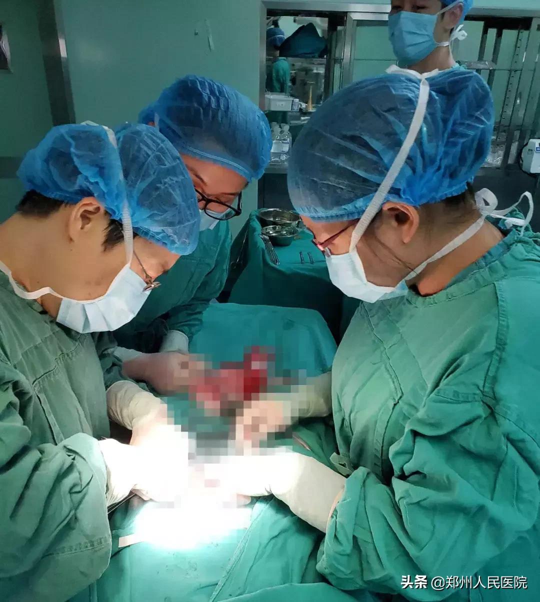 “重生”与新生，无肛女孩儿与郑医13年的缘分