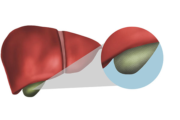 肝功检查单纯的胆红素偏高要紧吗,肝脏正常胆红素偏高还用查什么