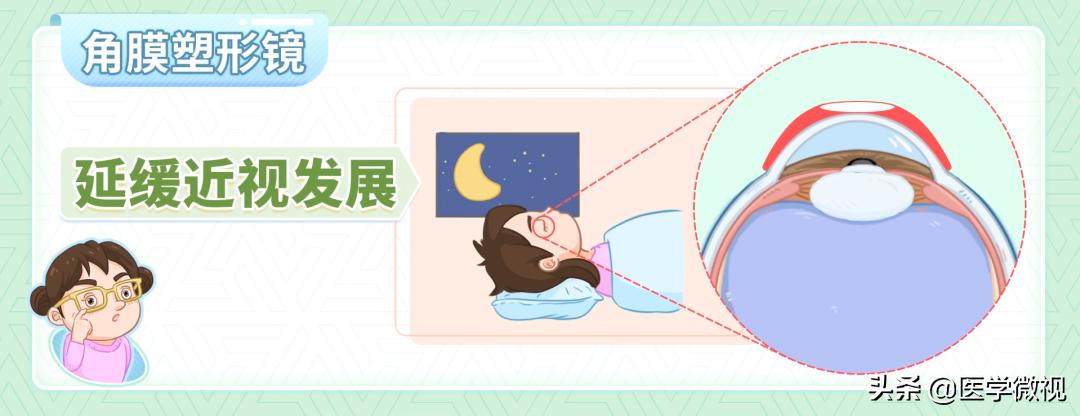 为什么孩子近视了要做视力矫正,孩子近视最好的防控方法