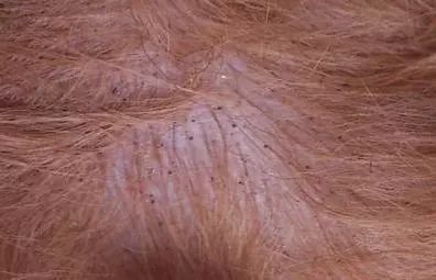 狗狗身上跳蚤反复出现怎么办,狗狗身上有跳蚤有什么处理方法