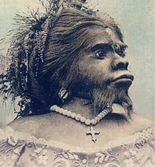 她身高1米38,拒绝20个求婚者,活着被当摇钱树,死后被做成标本