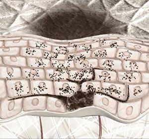 人身上长的黑痣瘊子能变癌症吗,手上长小黑痣会是癌症信号吗