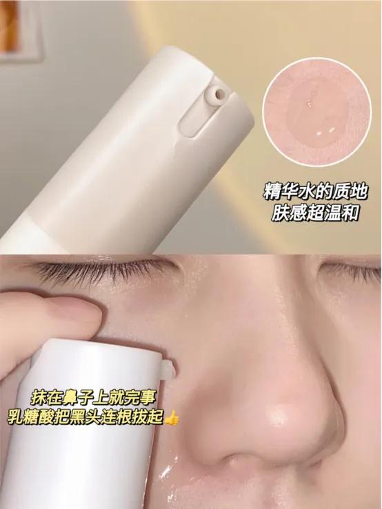 深度清理毛孔黑头教程,清洁毛孔里的黑头和白头小妙招