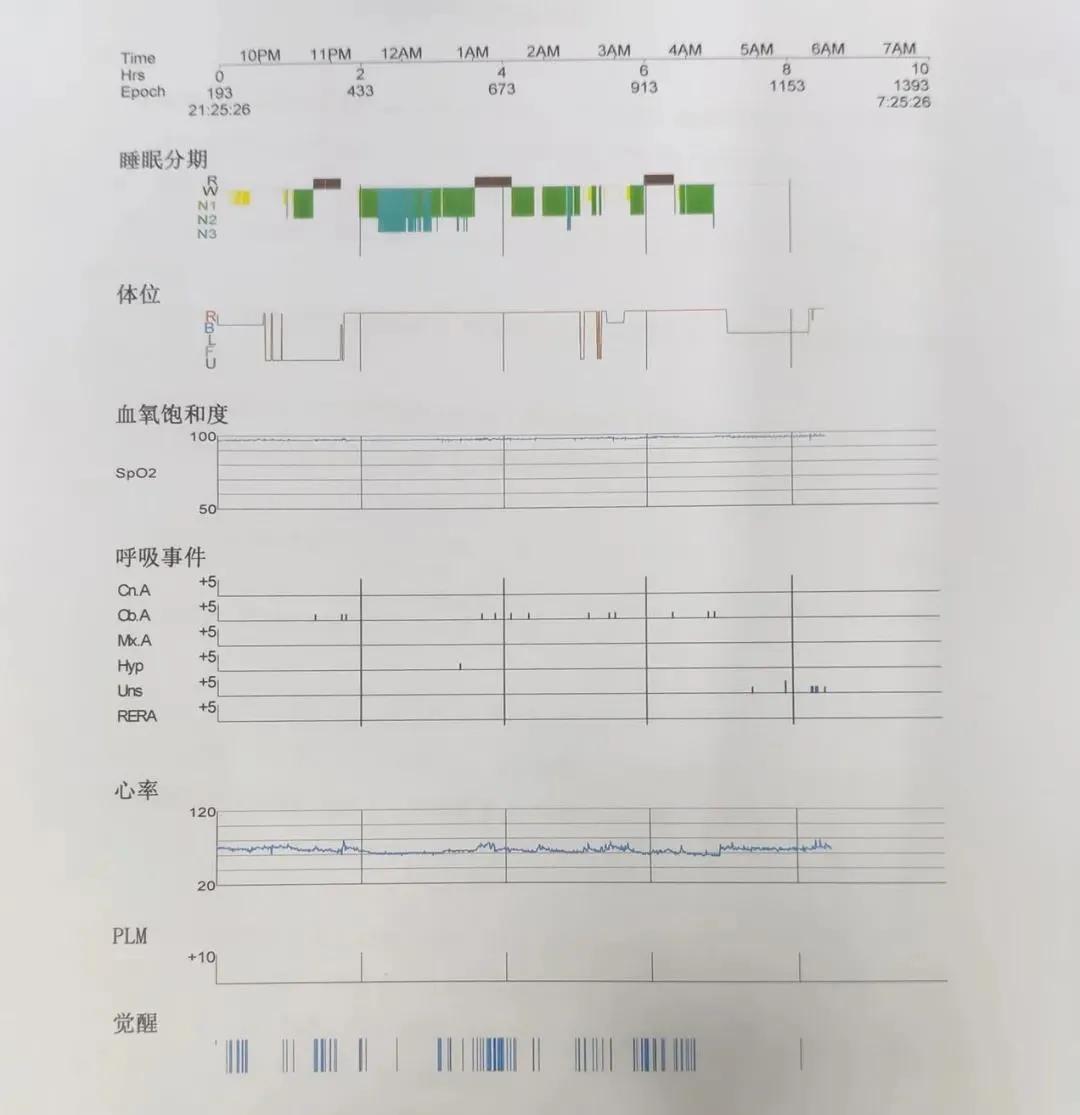 打鼾被憋醒还能听到鼾声,睡觉打鼾并且呼吸暂停把自己憋醒