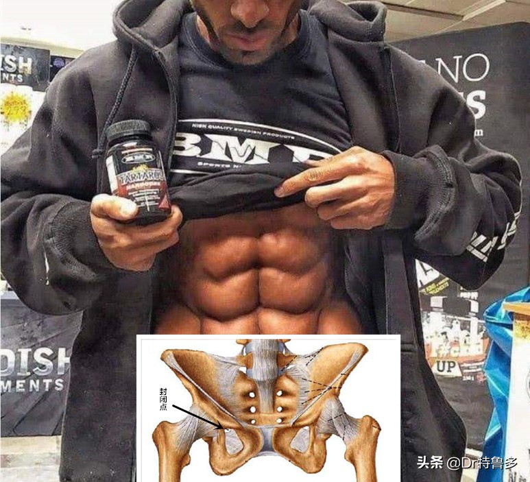 大腿内侧痛,胯也痛...有根神经被卡住了