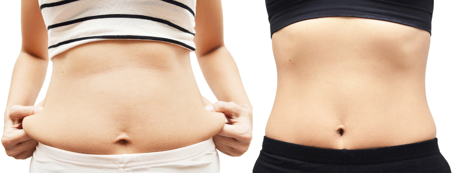 胖肚子和腰围是什么原因,什么原因容易导致肥胖肚子大